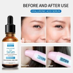 Alternative view of Original Pretty Cowry™ Hyaluronic Acid Serum – 100% Natural Anti-Wrinkle Professional Skin Care